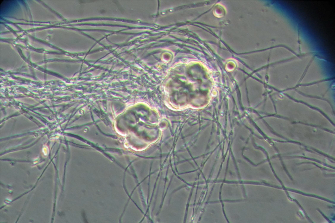 Microrganismi in campo – teoria e pratica in agroecologia